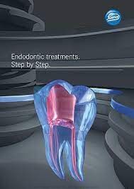 Picture for category Endodontics Files