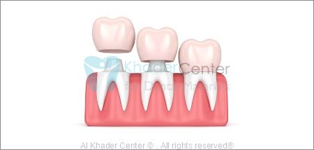 Picture for category Glass ionomer Cements