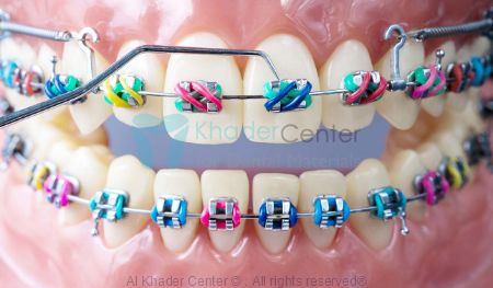 Picture for category Orthodontics